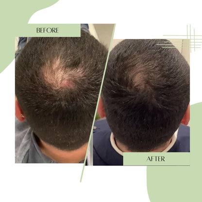 Hairloom Booster Doze - Complete Hair Recovery Kit