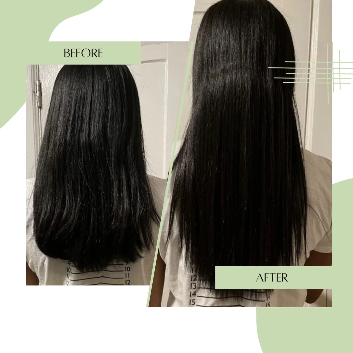 Hairloom Booster Doze - Complete Hair Recovery Kit