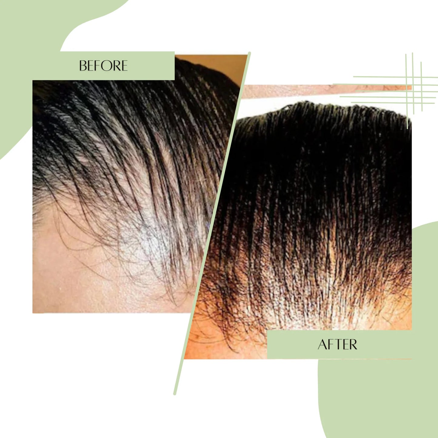 Hairloom Booster Doze - Complete Hair Recovery Kit