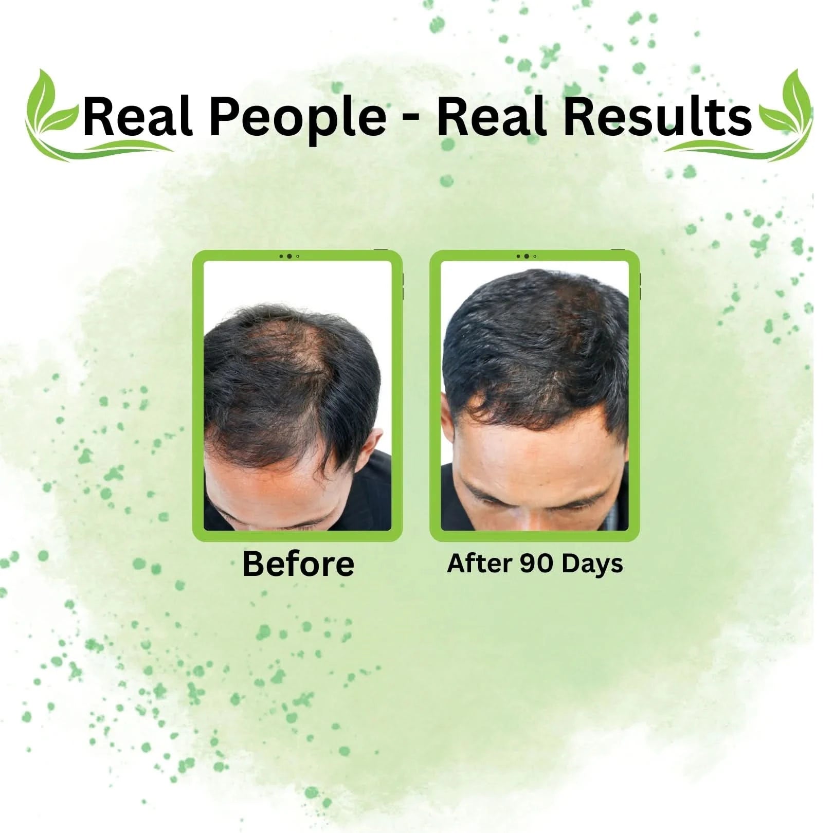 One Stop Solution for Every Hair Problem – Hairloom Booster Doze - Hairloom