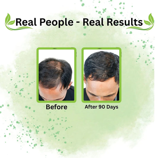 One Stop Solution for Every Hair Problem – Hairloom Booster Doze - Hairloom